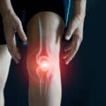 Arthritis in the Knee: Pain, Relief, and Fun 🦵🏼💊💡
