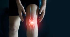 Arthritis in the Knee: Pain, Relief, and Fun ????