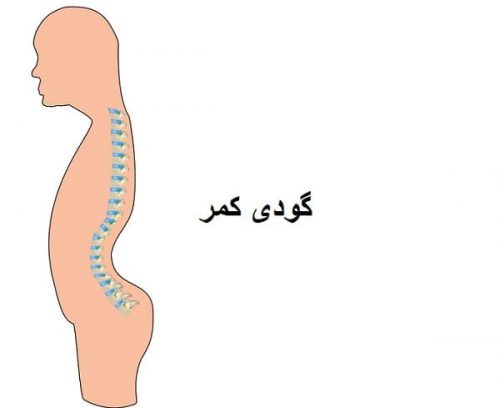 گودی کمر چیست