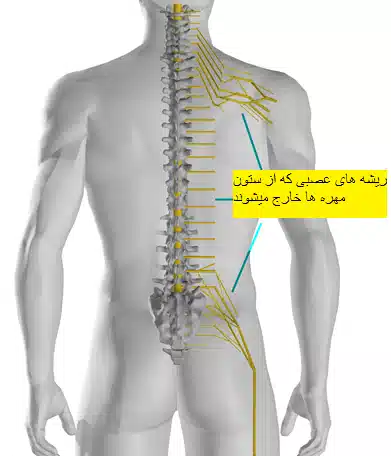 درمان دیسک
