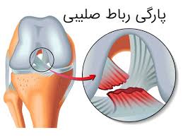 رباط صلیبی