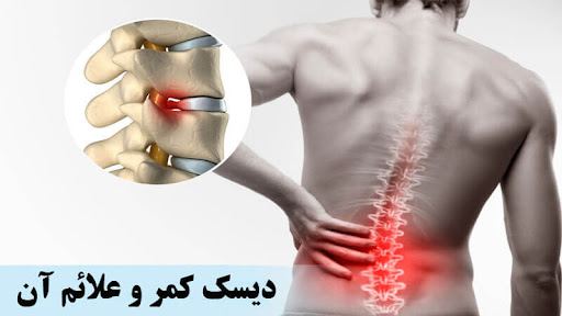 آیا دیسک کمر خوب می شود