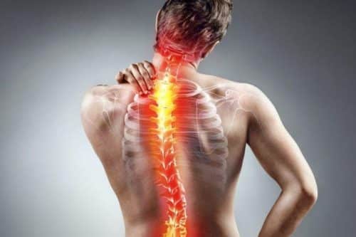 اسکولیوز و کمردرد
