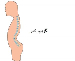 گودی کمر چیست